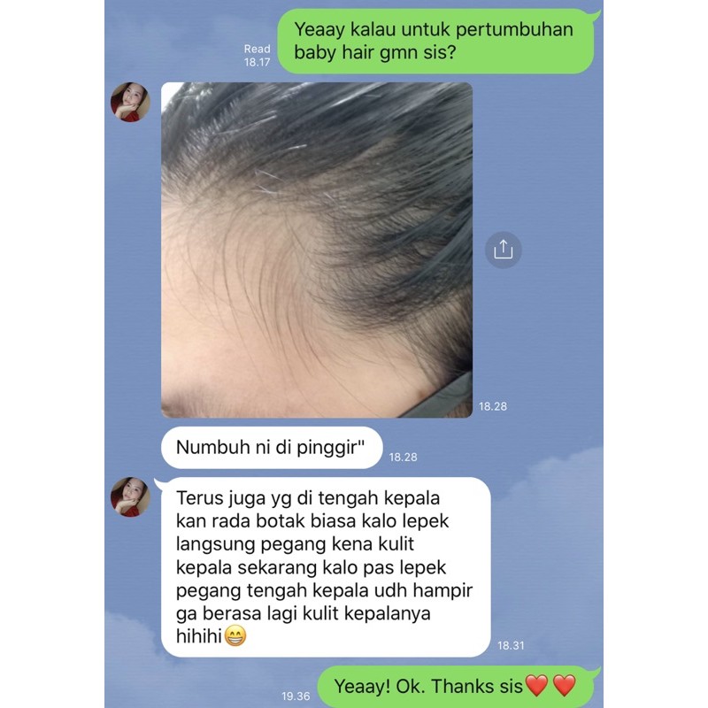 Scalp Therapy Natural Vegan Water-Based Hair Tonic - Everlaskin-8