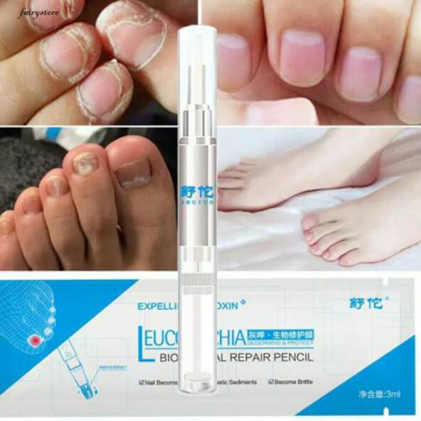 SALEE.. cream jamur kuku salep obat jamur kuku / cream anti jamur kuku