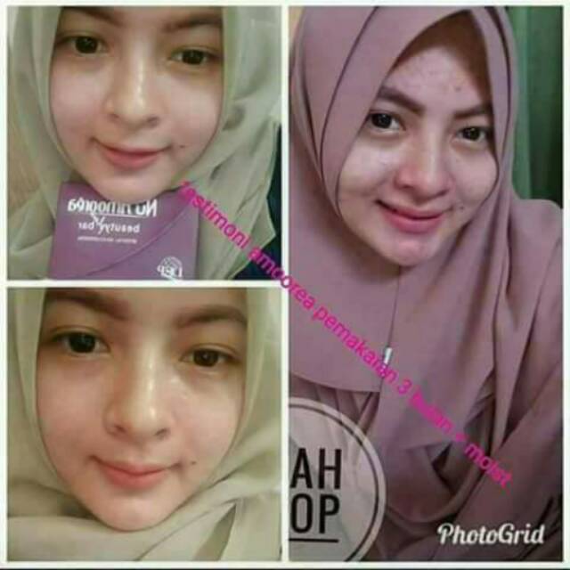 Promo!sabun nu amoorea beuty plus bar