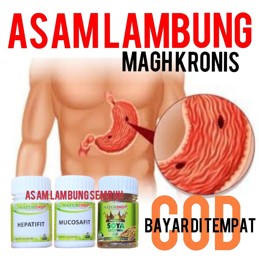 Obat Asam Lambung,Radang Lambung,Gerd, Tukak Lambung,Kanker Lambung,Obat Maag herbal NATURINDO