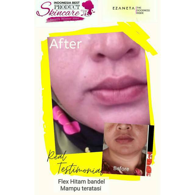 ECER EZANETA/SABUN/TONER/CREAM SIANG/CREAM MALAM/AMAN&BPOM/SKINCARE AMAN UNTUK BUMIL DAN MENYUSUI