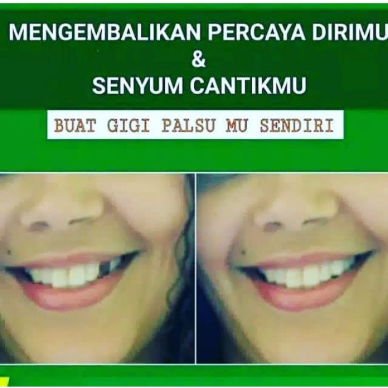 temporary tooth repair