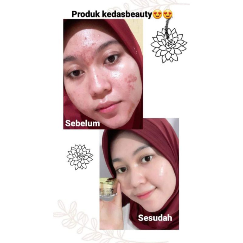 SABUN KEDAS BEAUTY BRIGHTENING SOAP ORIGINAL 100%-7