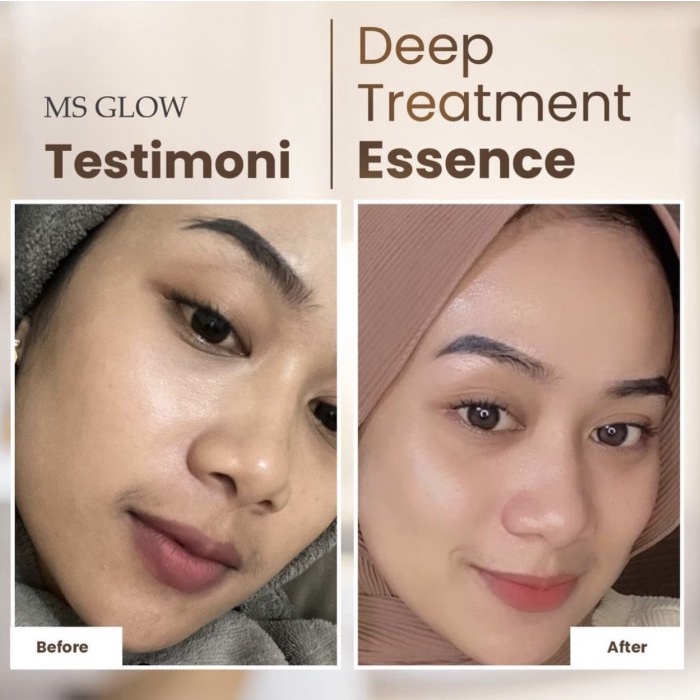 Ms Glow Deep Treatment Essence Salmon DNA