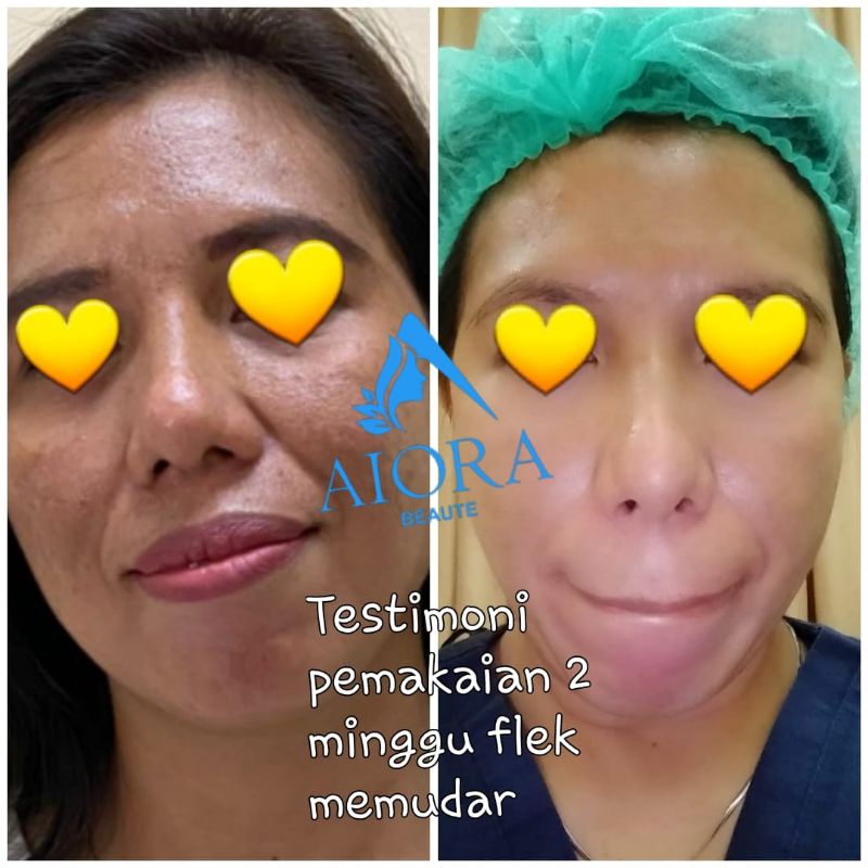AIORA skincare