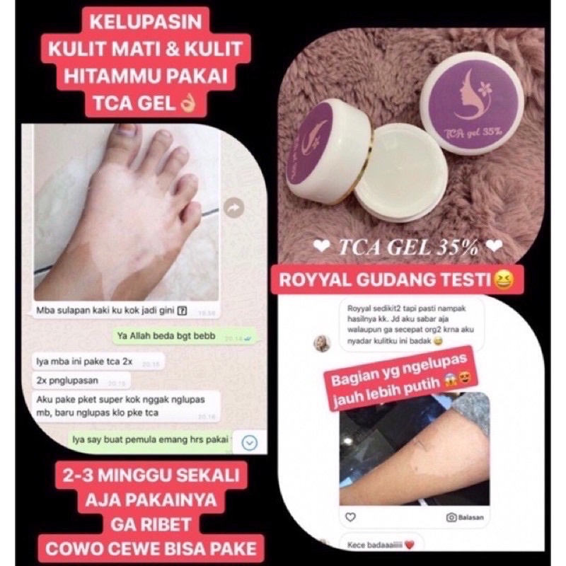 PEELING CREAM BADAN AMPUH MEMUTIHKAN MENGHILANGKAN BEKAS LUKA