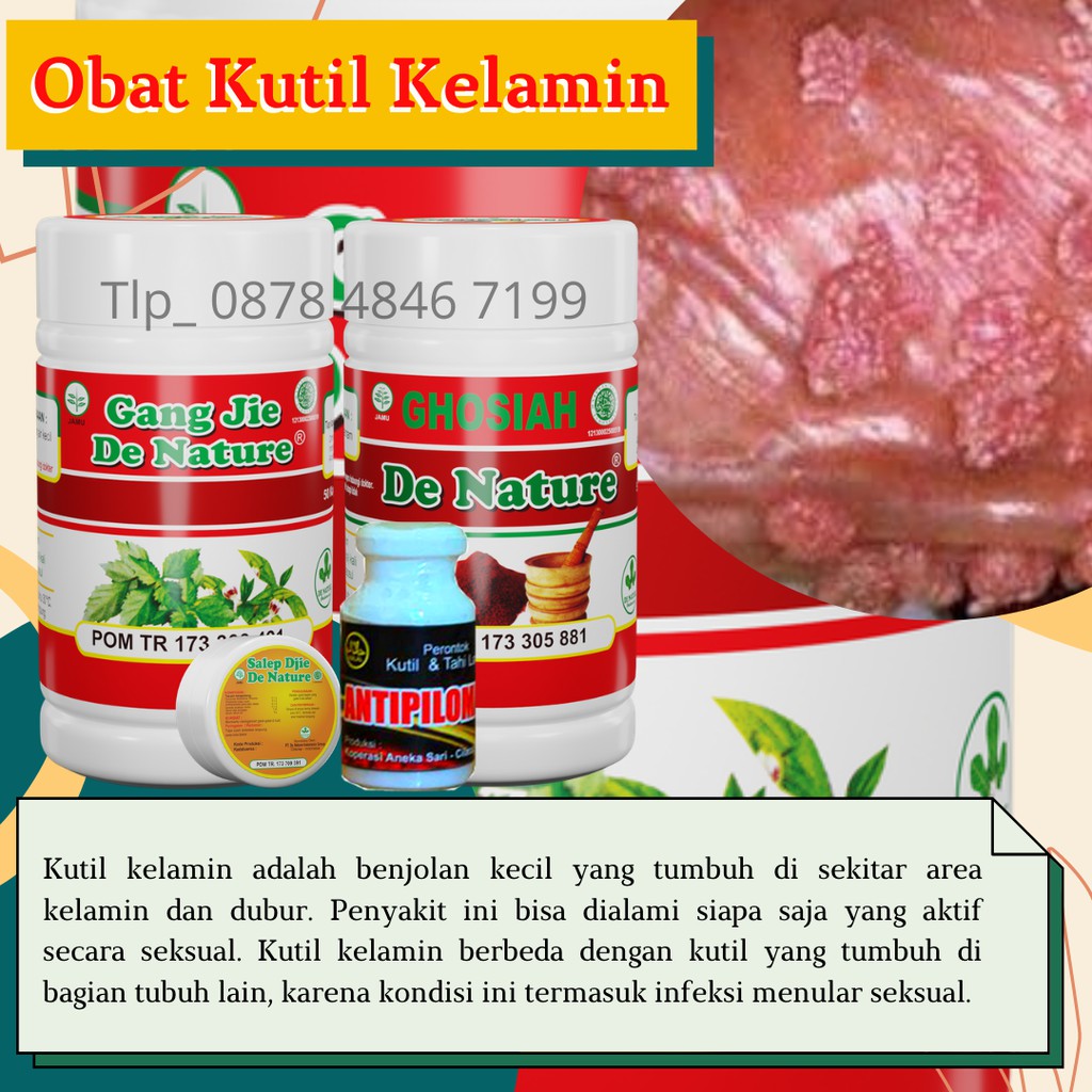 OBAT KUTIL KELAMIN,JENGGER AYAM,KUTIL DI ANUS SELANGKANGAN,HPV,