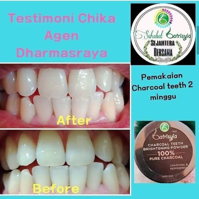 Charcoal teeth brightening powder batrisyia/ pemutih gigi alami ampuh/perontok karang gigi