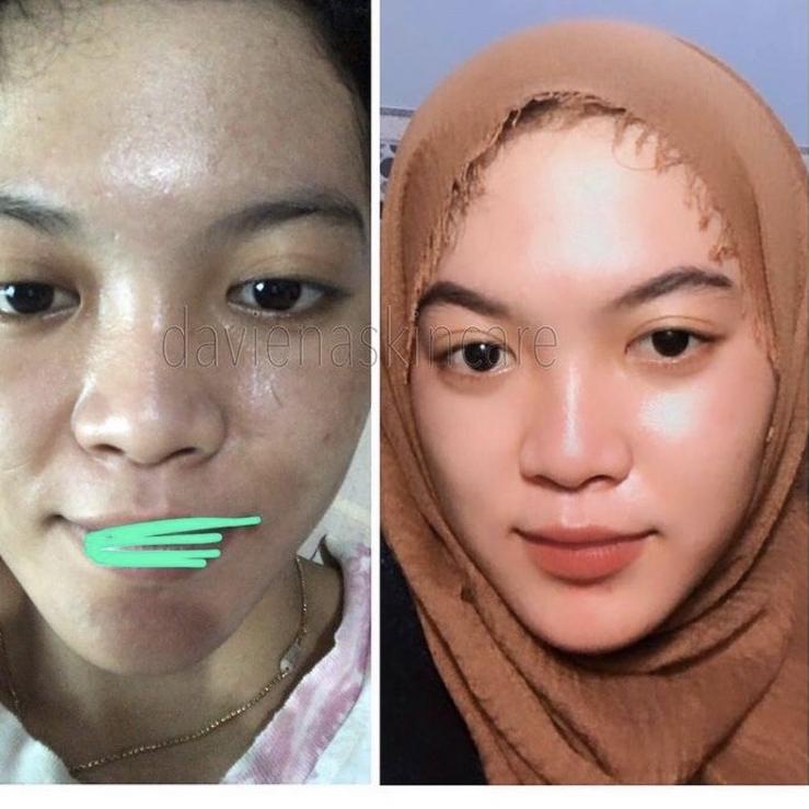 TRX3z3Yn-- GLOWING / WHITENING SERIES DAVIENA SKINCARE