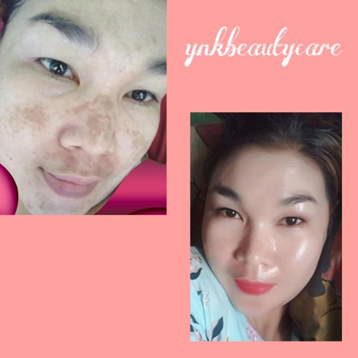 Dijamin Ori PAKET FLEK PREMIUM YNK BEAUTYCARE 457