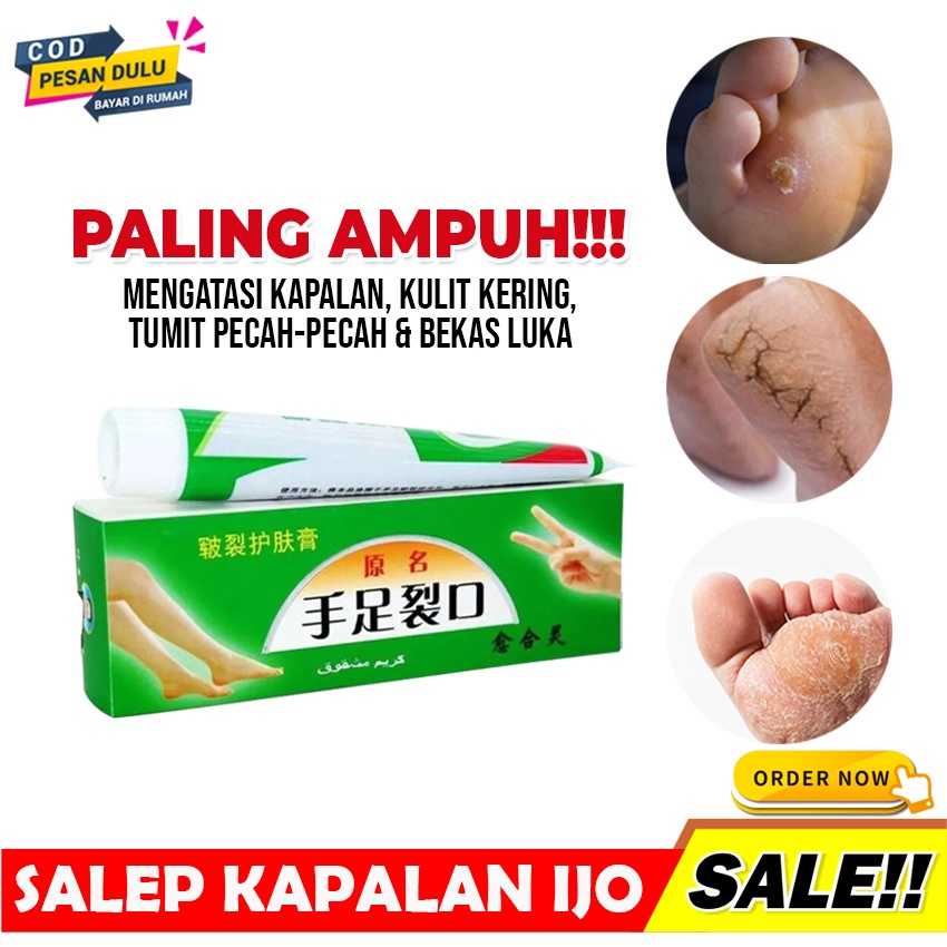 SHINE STAR - [ BISA COD ] SALEP KRIM HERBAL ATASI TUMIT KAKI TANGAN KERING EKSIM PECAH PECAH DAN KAPALAN