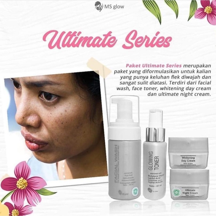 PAKET ULTIMATE penghilang flek hitam membandel MS GLOW dijamin original