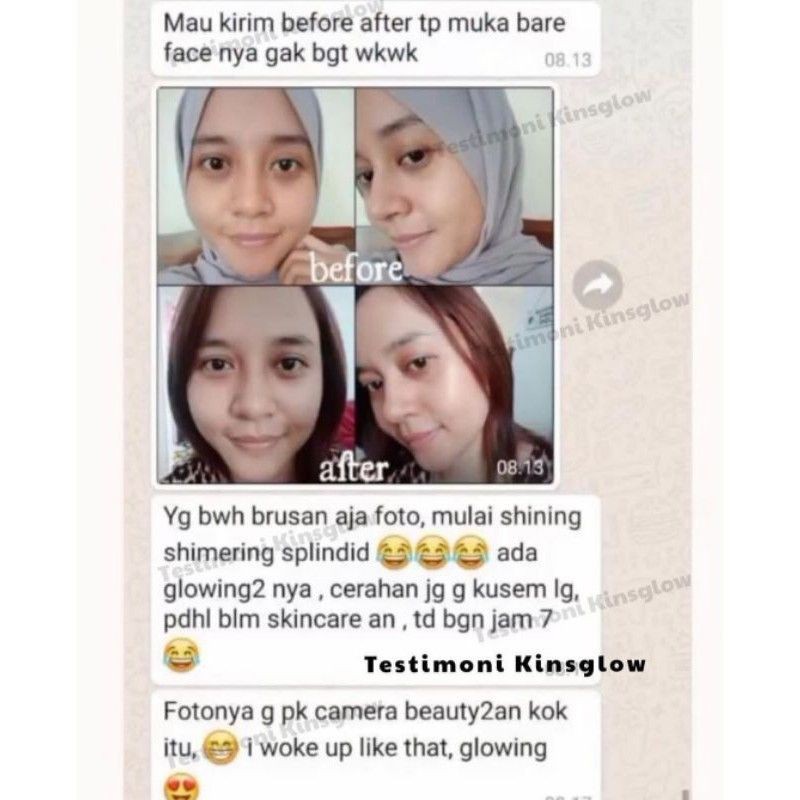 KINSGLOW SKINCARE ORI | KINSGLOW BEAUTY SKINCARE | CREAM KINSGLOW PAKET KECANTIKAN | FLEK HITAM