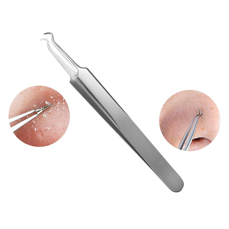 Alat penghilang Komedo Jerawat Blackhead 3 PCS - PT3 - Silver