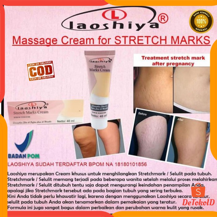 Penghilang Stretch Mark Laoshiya Penghilang Selulit Guratan Kulit Di Perut Kaki Tangan Original Shopee Indonesia
