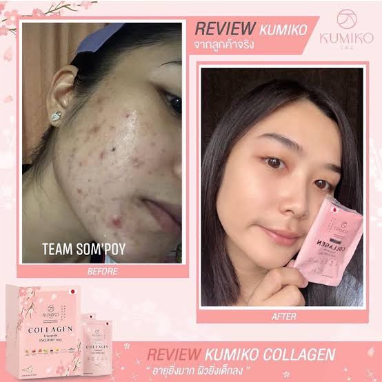 Kumiko Collagen Tripeptide 150.000mg/Minuman collagen/Collagen pemutih kulit/pemutih wajah/pemutih badan/anti jerawat