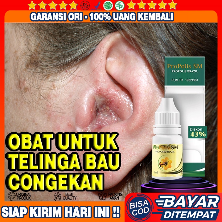 Obat Telinga Bau conge , Telinga Bau dan Berair, Telinga Bernanah, Keluar Darah, Curek,