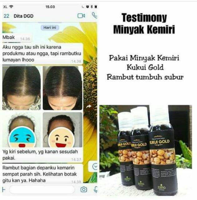 Minyak Kemiri Bakar Kukui Gold 100ml Penyubur Rambut Rontok Penyubur Rambut Bayi Shopee Indonesia