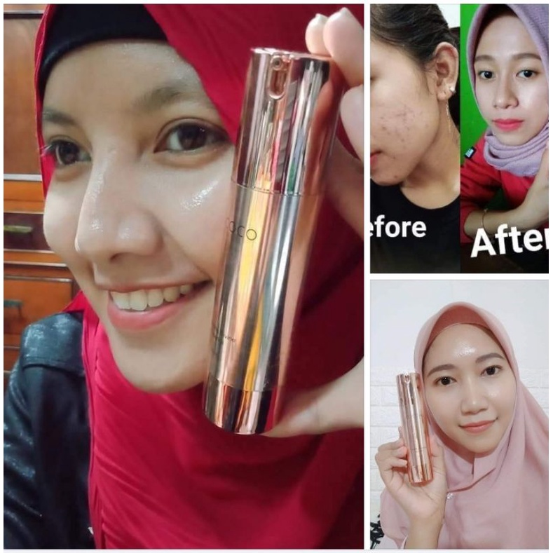 lacoco hidrating divince essence /Hde Nasa essence anti bopeng