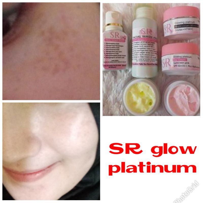 SR platinum glowing
