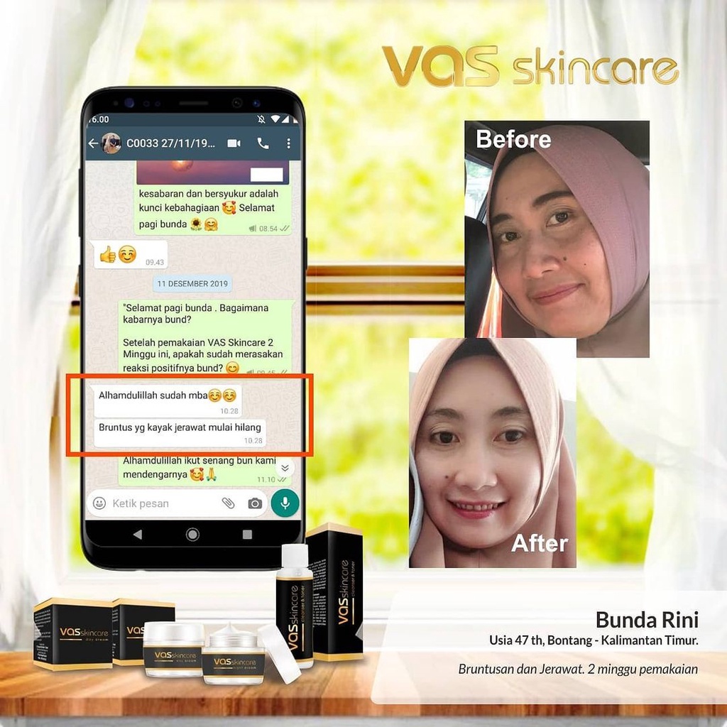 (GRATIS ONGKIR) Paket Premium VAS Skincare asli krim cream serum penghilang flek hitam membandel di wajah penghilang jerawat dan bekas jerawat pemutih glowing ampuh permanen bpom alami original