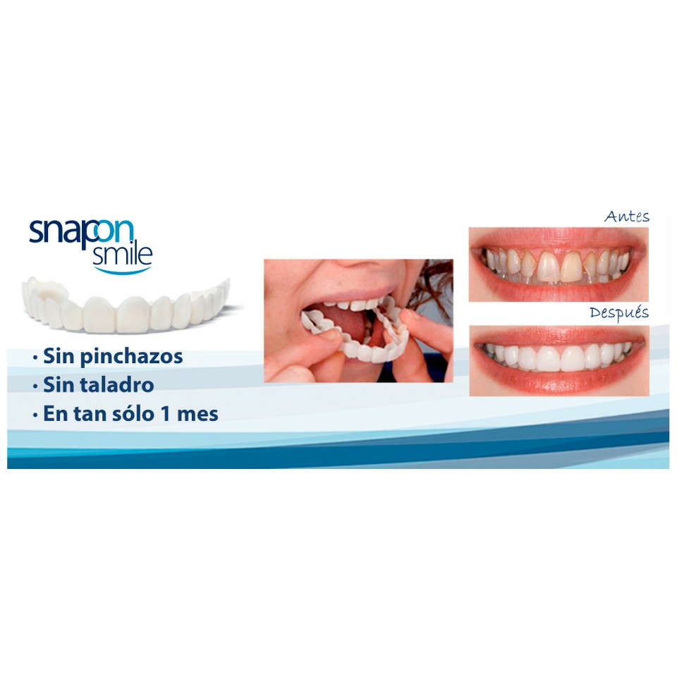 Snap On Smile