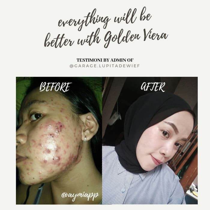 ✨ AKU MURAH ✨Golden Viera Soap / Sabun Pembersih Wajah