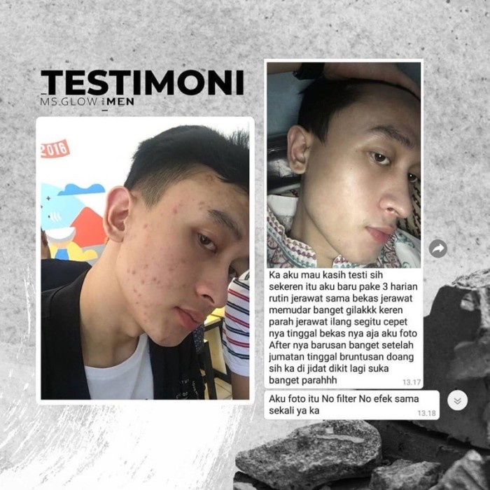 MS Glow Paket Lengkap Maskulin Perawatan Wajah Pria Mencerahkan dan Melembabkan Kulit Maskulin Body Lotion Sekaligu Parfume BPOM COD-6