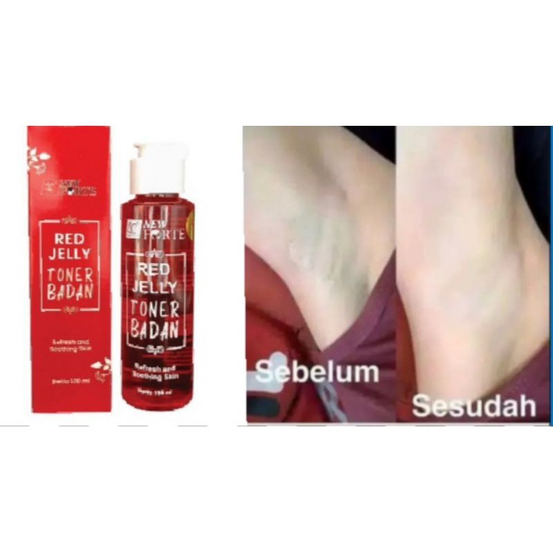 SYB Forte AHA Skinboost | Red Jelly | Coklat Toner Badan 100ml