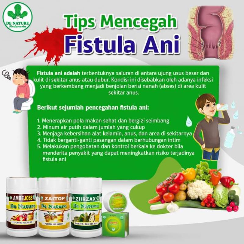 Obat Fistula Ani