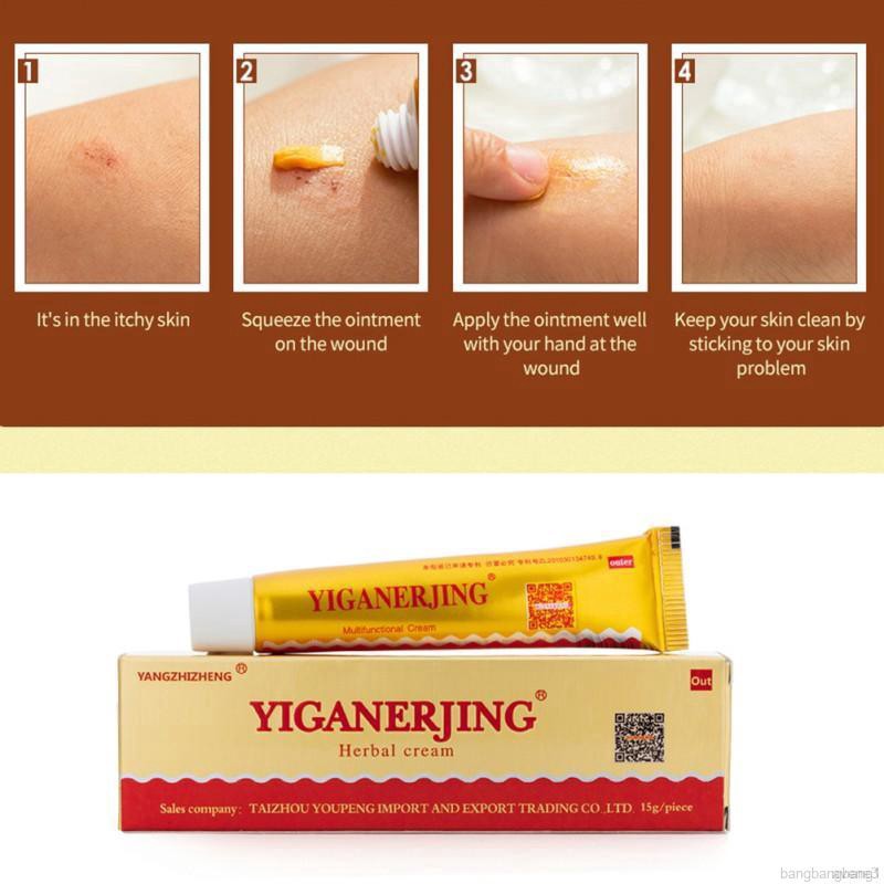 SALEP HERBAL YIGANERJING OBAT EKSIM PSORIASIS CREAM DERMATITIS VITILIGO JAMUR JERAWAT AMPUH