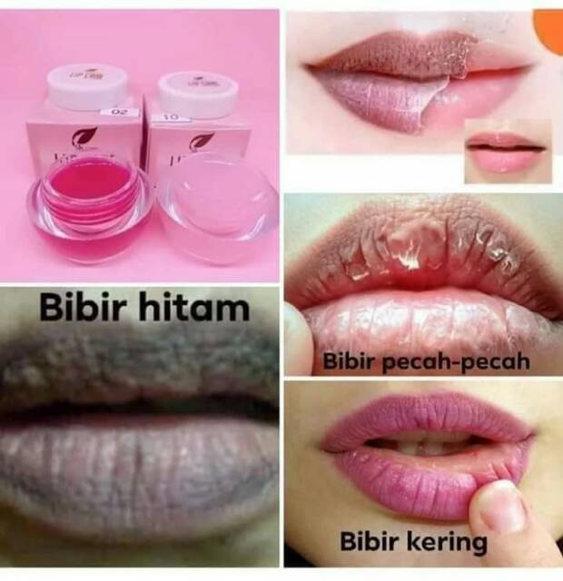 Lip Care Sr12 Lipbalm Pelembab Bibir Pencerah Warna Bibir Hempas Bibir Kering Pecah Pecah Shopee Indonesia