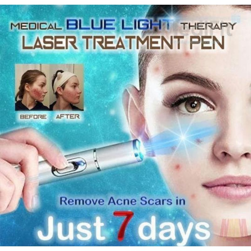 LASER TREATMENT PEN BLUE LIGHT Penghilang Jerawat Parises dll.