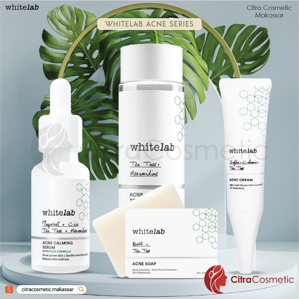 Whitelab Acne Series | Toner | Calming Serum | Acne Cream | Acne Soap