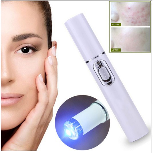 Pen LED Biru Laser Penghilang Jerawat Acne Treatment - KD-7910