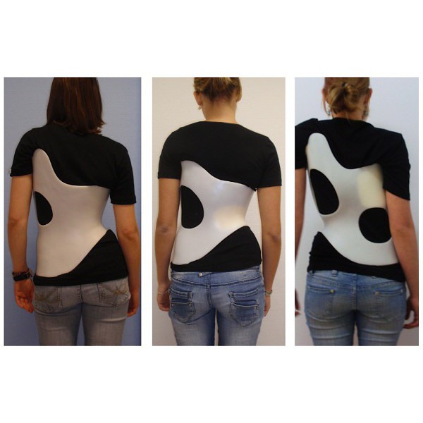 Muenster Scoliosis Orthosis / MSO Brace / Scoliosis Brace / Postur / Koreksi Skoliosis / Ortopedi