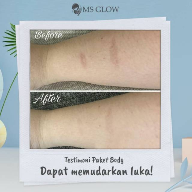 MS Glow Body Lotion - 1 Item - Pemutih Badan