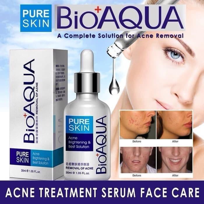 Unik BIOAQUA PURE SKIN ACNE REMOVAL SERUM /SERUM ACNE BIOAQUA Murah