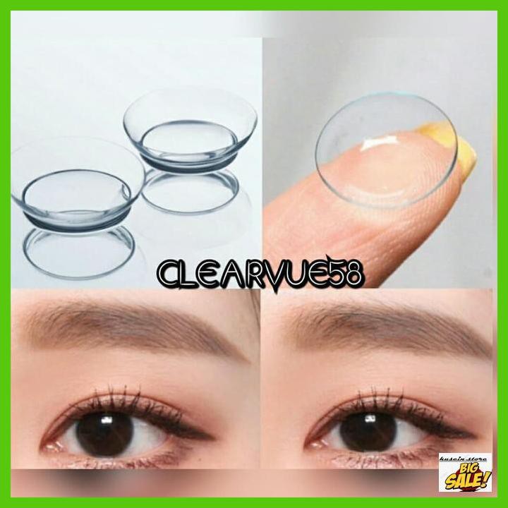 

SOFTLENS- SOFTLENS BENING CLEARVUE58 MINUS SD -10.00 - MINUS TULIS KET -ASLIII.