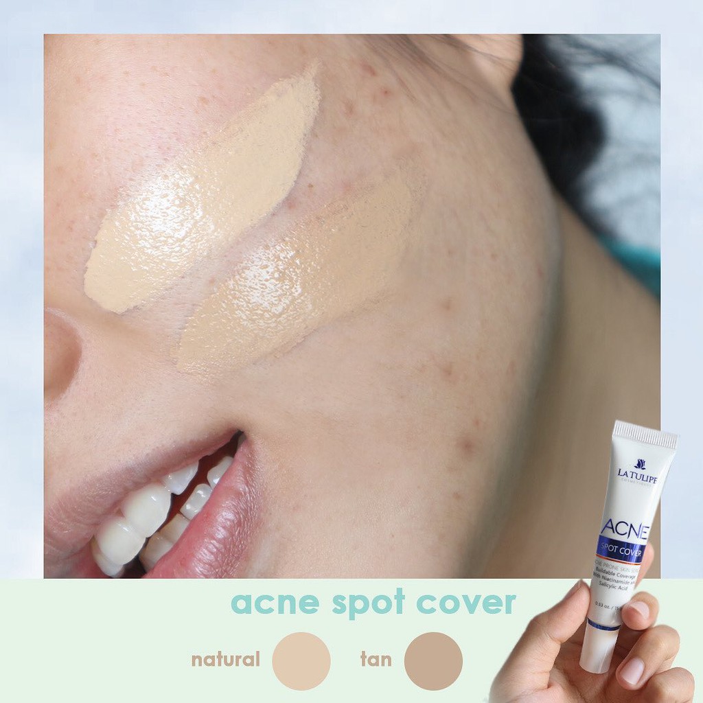 LA TULIPE ACNE SPOT COVER 15 GR @MJ