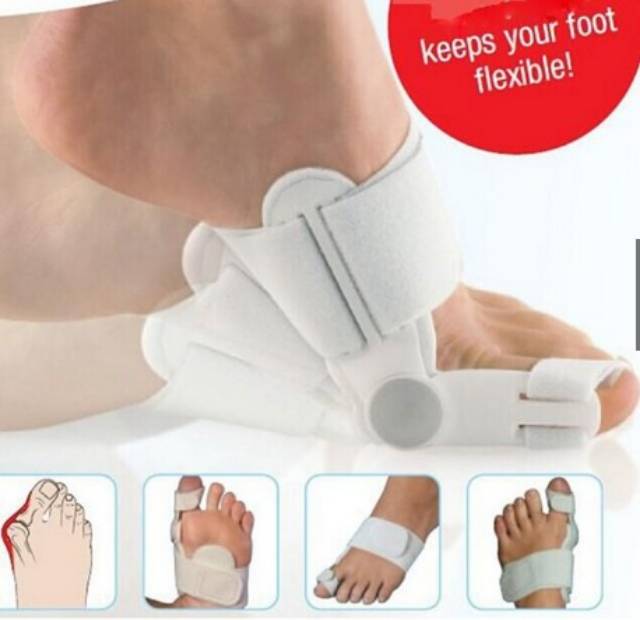 Bunion Hallux valgus Terapi Pelurus Jempol Kaki