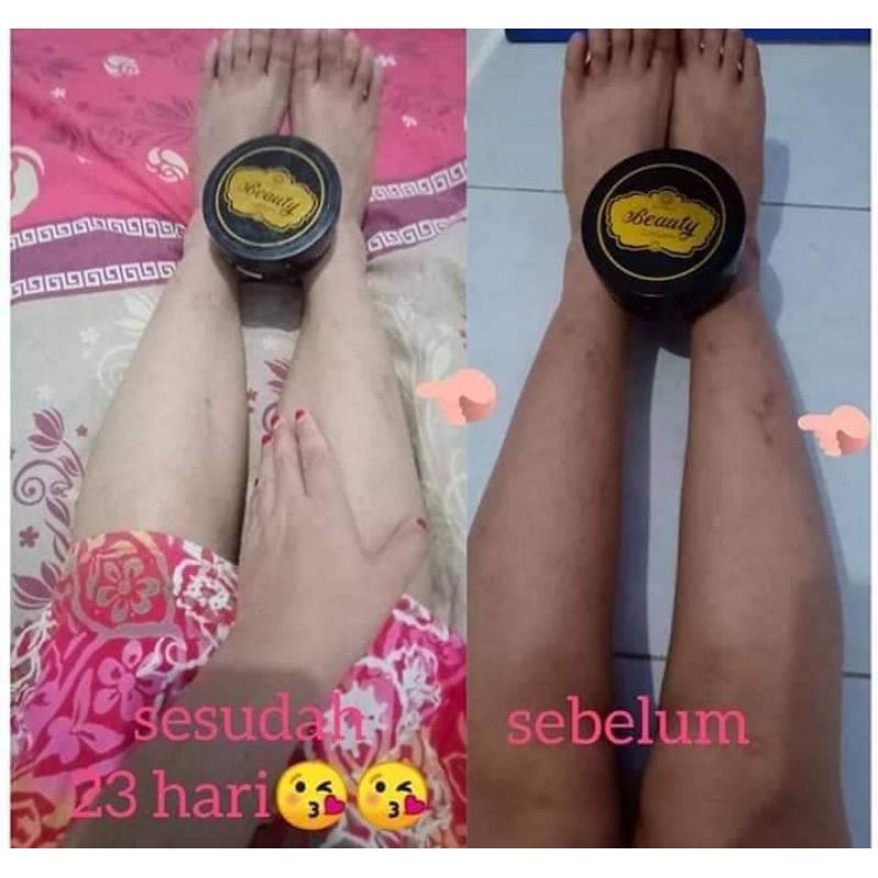 BEAUTY LOTION DAN BEAUTY SCRUB ORIGINAL RK COSMETICS PENCERAH ALAMI KULIT BPOM