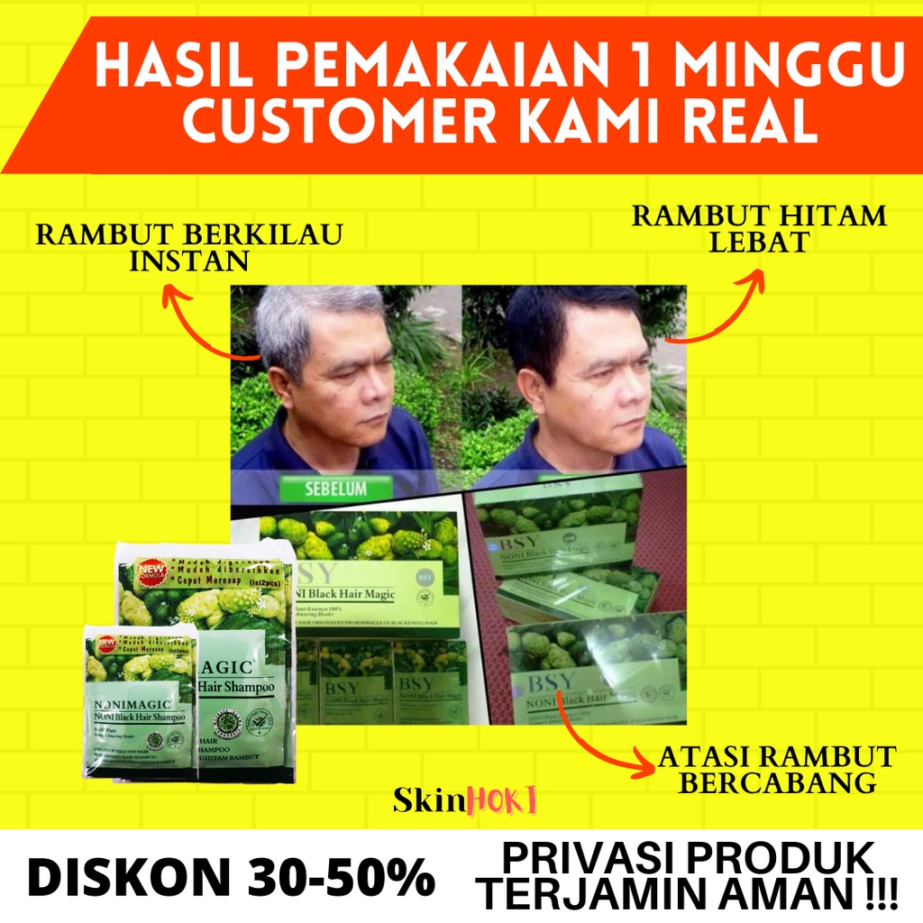 SHAMPO UBAN PENGHITAM UBAN PERMANEN PENYUBUR RAMBUT BSY NONI MAGIC BLACK HAIR SHAMPO HALAL PENGHILANG UBAN ORIGINAL BPOM