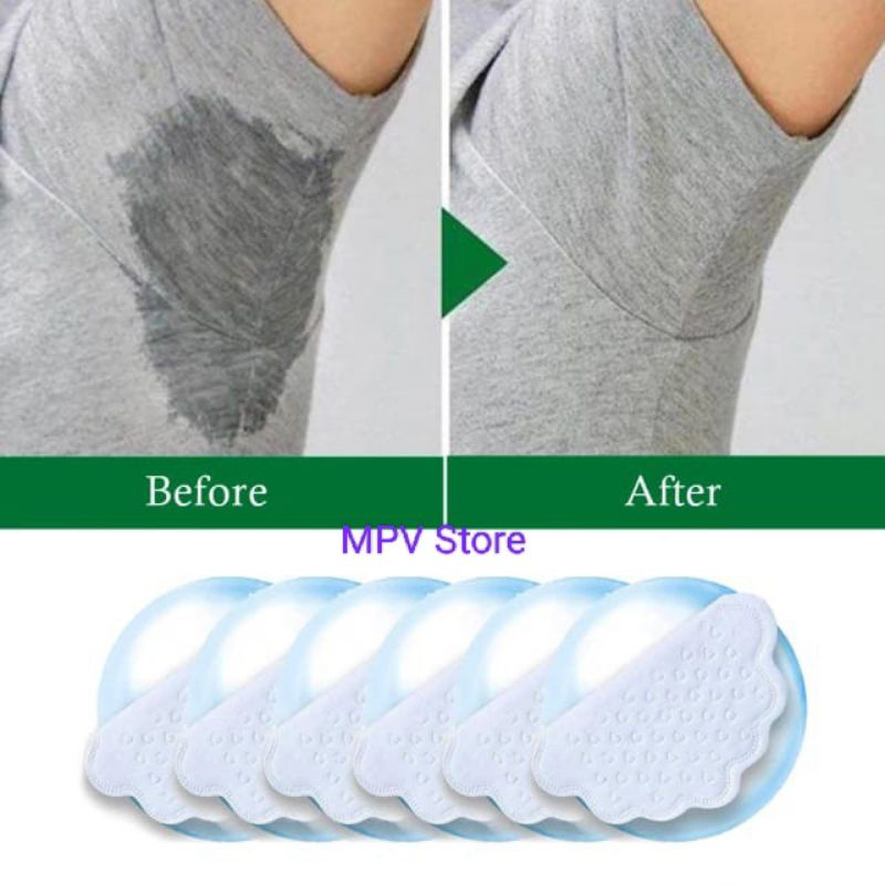 Armpit Bantalan Penyerap Keringat Ketiak l Anti Bau Ketiak l Anti Basah Ketiak l Armpit Sweat Pads