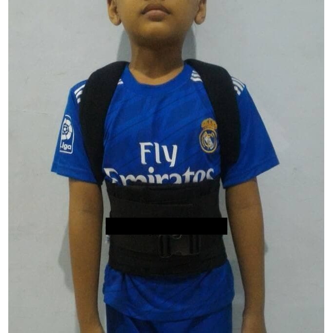 Korset TLSO Anak