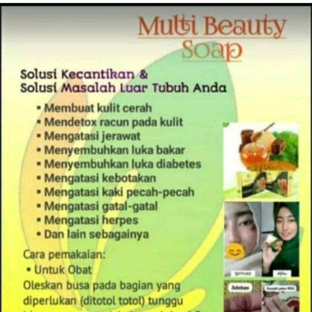 sabun multibeauty(MBS)
