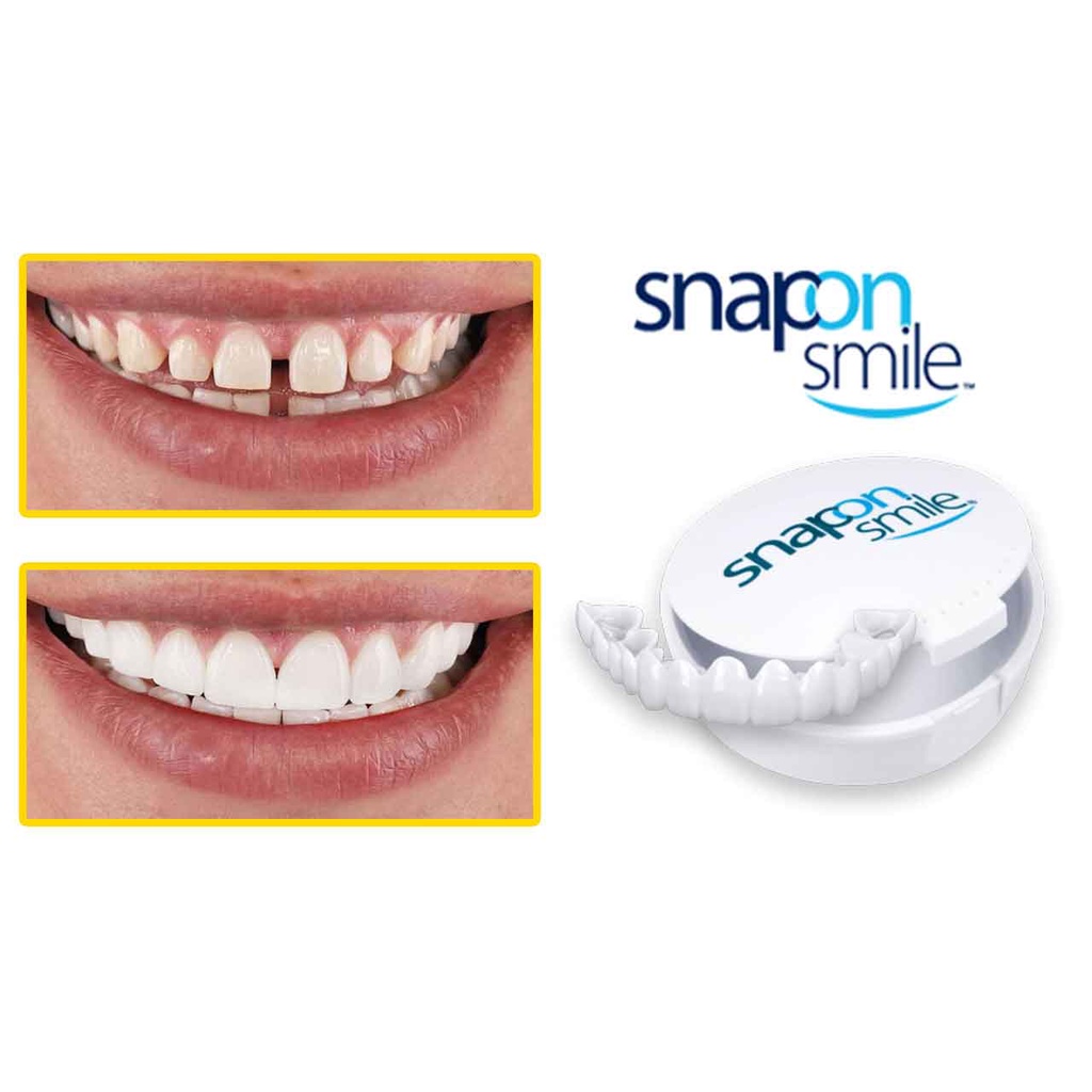 COD Snap On Smile Original 100% Authentic Gigi Palsu Snapon Smile 1 Set Veneer Gigi palsu