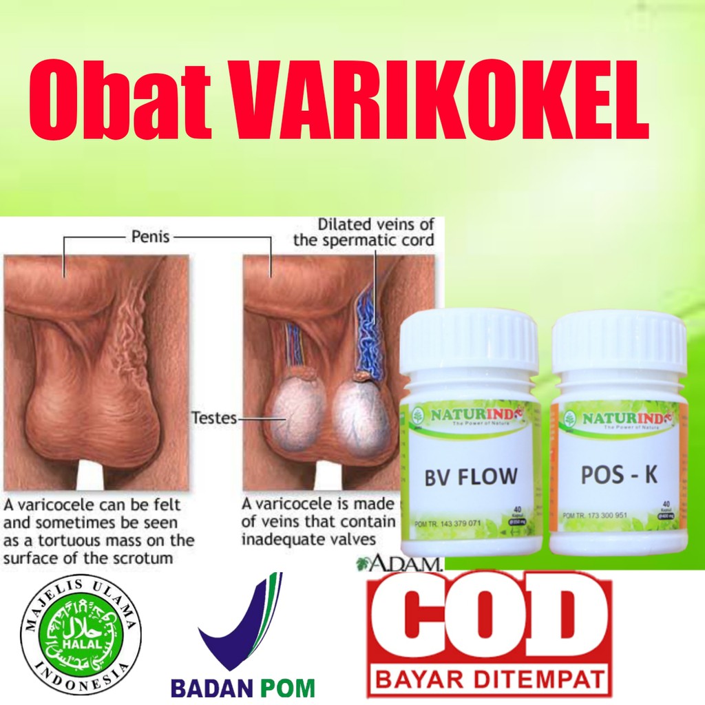 OBAT VARIKOKEL HERBAL BUAH ZAKAR BENGKAK MANDUL NYERI TESTIS BV FLOW POS K NATURINDO COD