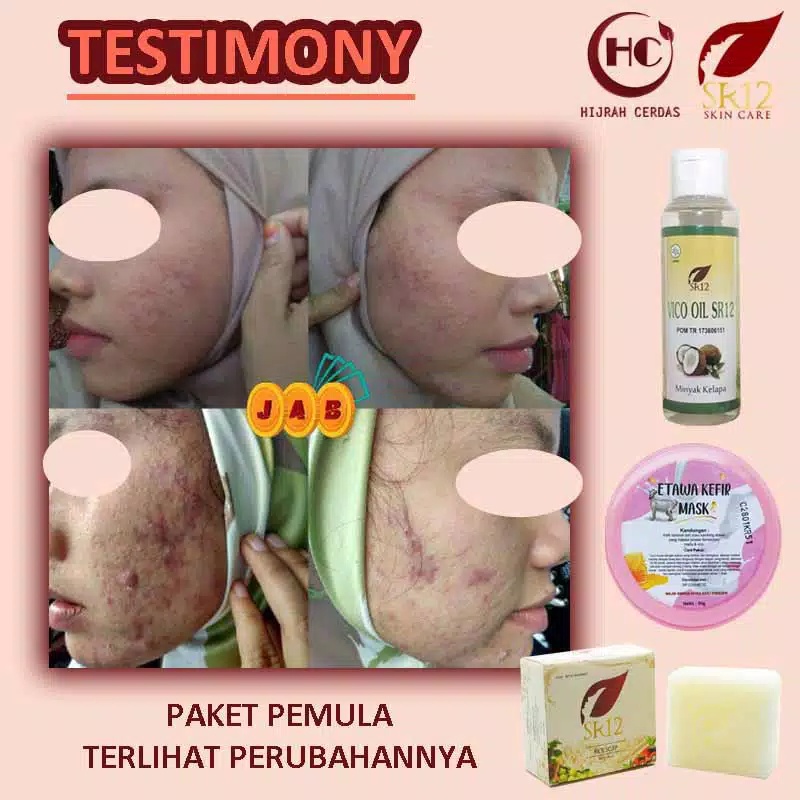 ETAWA KEFIR MASK SR12 BPOM/KEFIR ETAWA MASK SR12/KULIT BERMINYAK&amp;BERJERAWAT/KEFIR MASK SUSU KAMBING