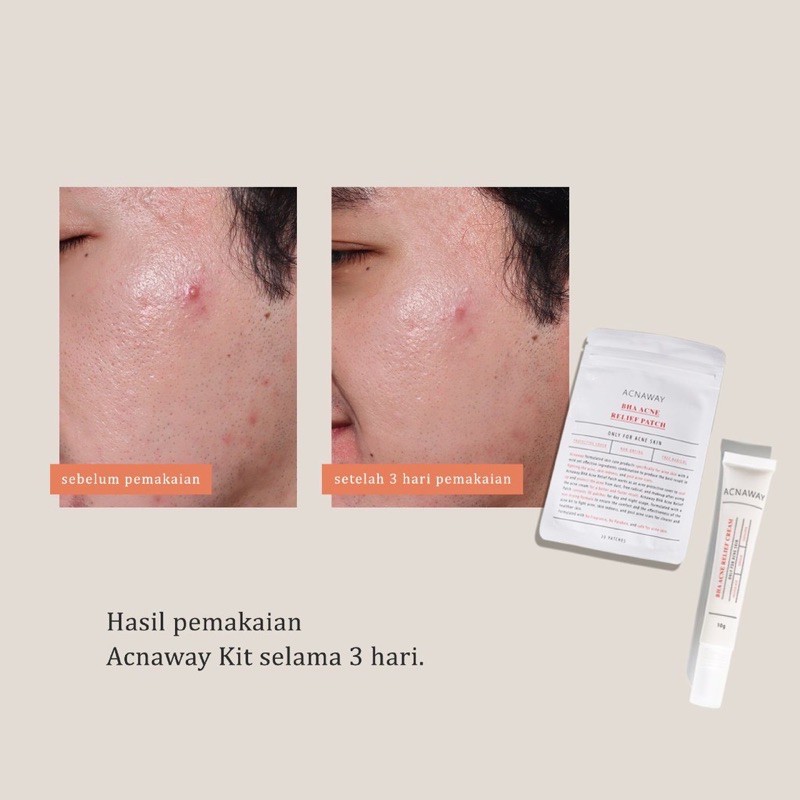 ACANAWAY Anti Acne Blemish Relief BHA Cream &amp; Patch Kit Obat Jerawat